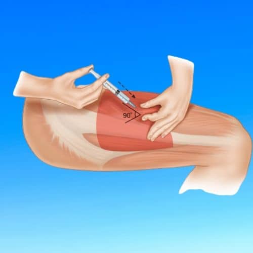 HOW TO SELF INJECT OR ADMINISTER TESTOSTERONE INJECTABLES